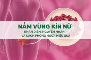 Nam-vung-kin-nu