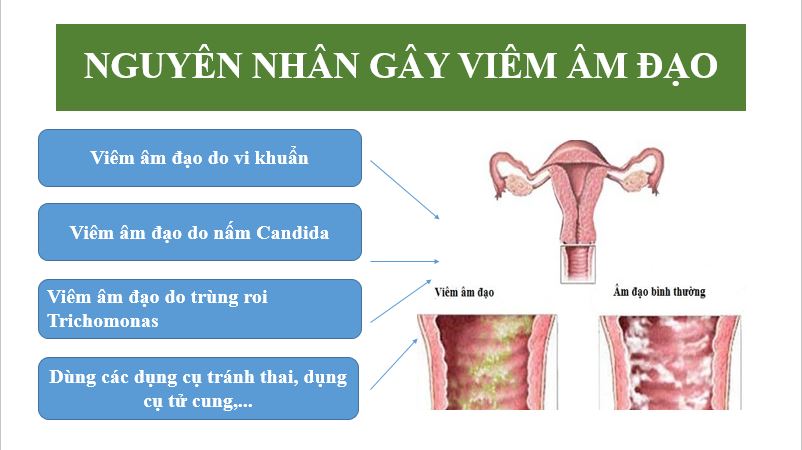 nguyen-nhan-gay-viem-am-dao