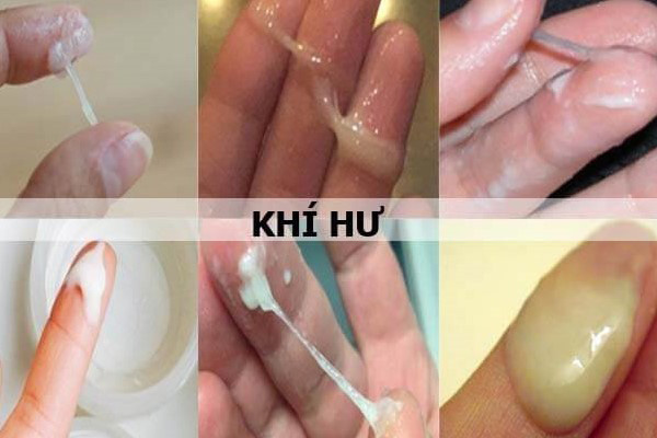 mau sac khi hu cua co be