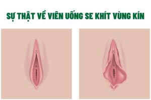 su that ve vien uong se khit vung kin